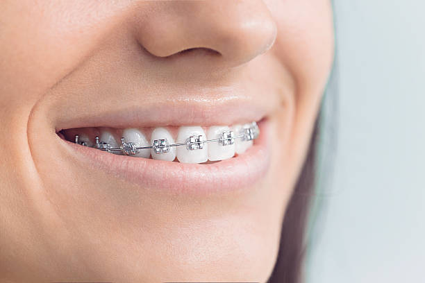 Best Teeth Whitening  in Union, NJ
